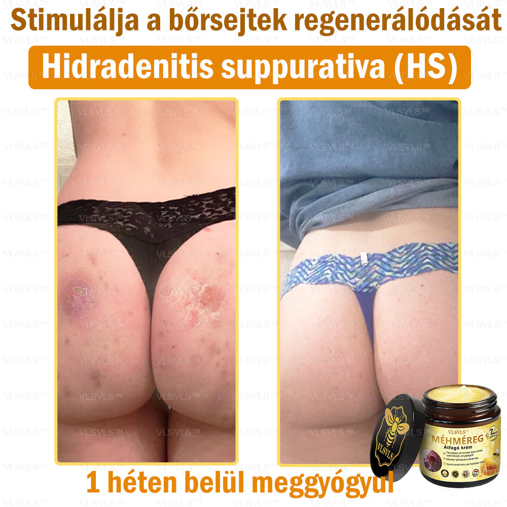 ⏰ Már csak 5 doboz maradt! További 50% kedvezményt biztosítunk! Legyen fitt és egészséges. Ha most veszít, csak jövőre lesz esélye.