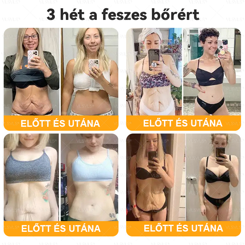 Magyarországról készült és szállított🌸VLSVLS® Méhméreg Bőrfelújító Krém 🔥🔥 UTOLSÓ NAP – 80% KEDVEZMÉNY