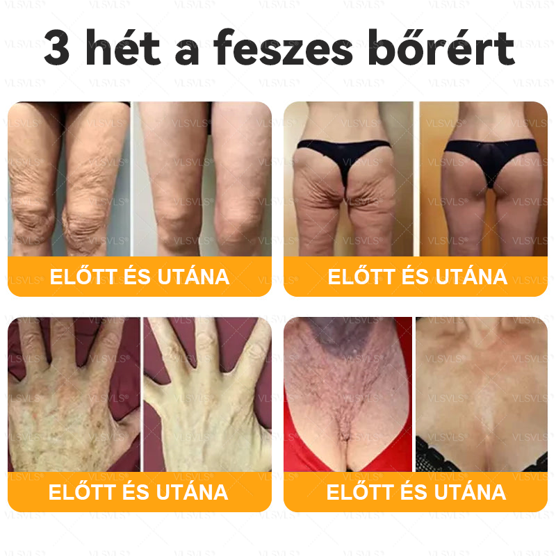 Magyarországról készült és szállított🌸VLSVLS® Méhméreg Bőrfelújító Krém 🔥🔥 UTOLSÓ NAP – 80% KEDVEZMÉNY