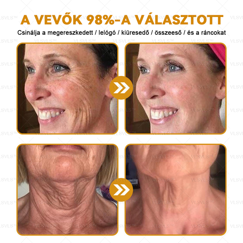 ✨𝑯𝒊𝒗𝒂𝒕𝒂𝒍𝒐𝒔 𝒃𝒐𝒍𝒕: PLTOWE™ Botox méhméreg ránctalanító krém🍀(Az akció utolsó napja: 50% kedvezmény) (Copy)