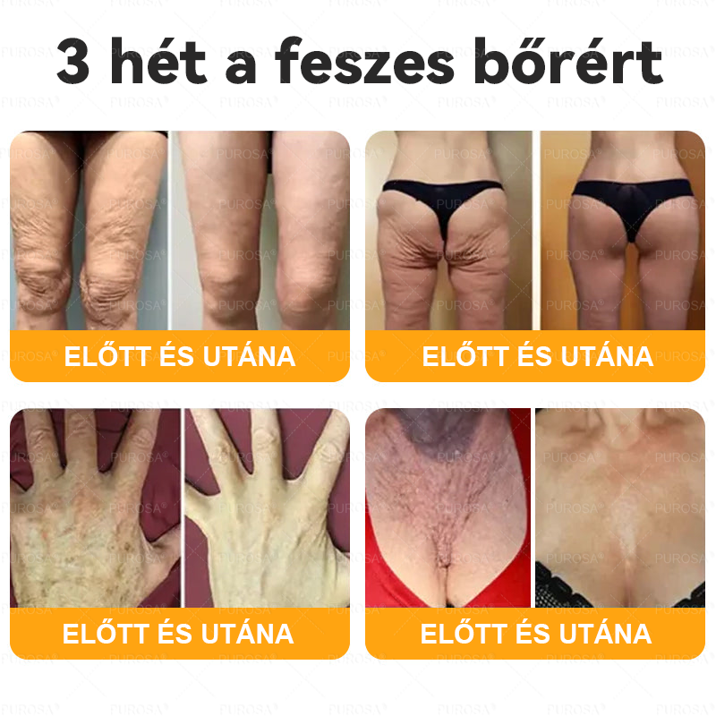 Magyarországról készült és szállított🐝🌸PUROSA® Méhméreg Bőrfelújító Krém 🔥 UTOLSÓ NAP – 80% KEDVEZMÉNY🔥