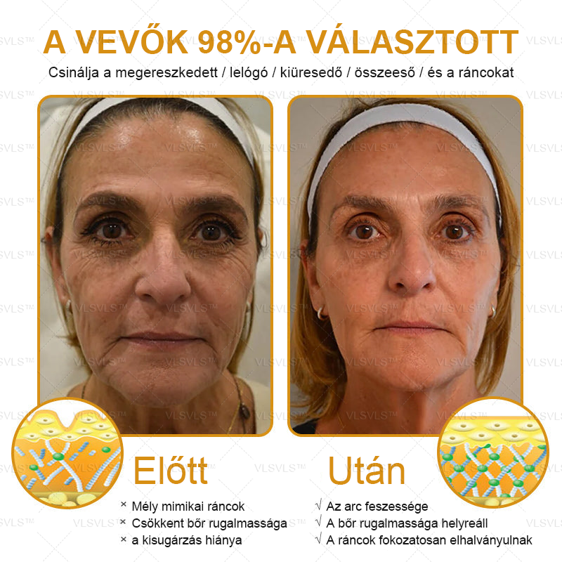 ✨𝑯𝒊𝒗𝒂𝒕𝒂𝒍𝒐𝒔 𝒃𝒐𝒍𝒕: PLTOWE™ Botox méhméreg ránctalanító krém🍀(Az akció utolsó napja: 50% kedvezmény) (Copy)