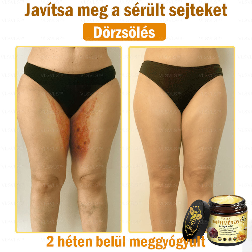 ⏰ Már csak 5 doboz maradt! További 50% kedvezményt biztosítunk! Legyen fitt és egészséges. Ha most veszít, csak jövőre lesz esélye.