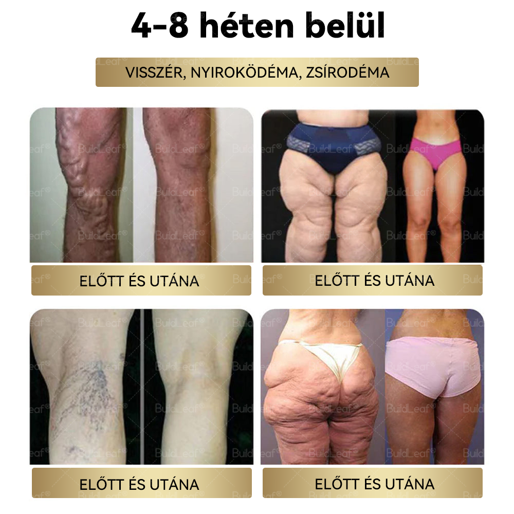 ⏰ Már csak 5 doboz maradt! További 50% kedvezményt kínálunk! Maradj fitt és egészséges. Ha most veszítesz, jövőre nem kapsz újabb esélyt.