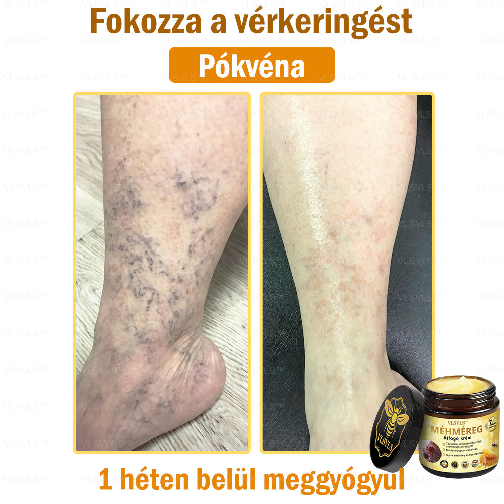 ⏰ Már csak 5 doboz maradt! További 50% kedvezményt biztosítunk! Legyen fitt és egészséges. Ha most veszít, csak jövőre lesz esélye.