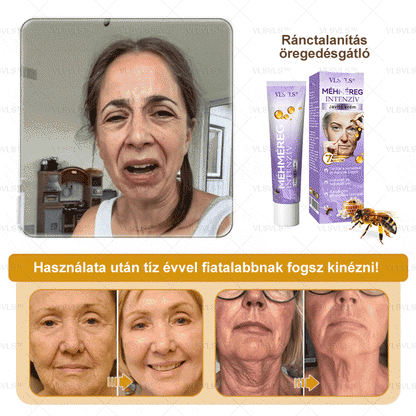 ✨𝑯𝒊𝒗𝒂𝒕𝒂𝒍𝒐𝒔 𝒃𝒐𝒍𝒕: PLTOWE™ Botox méhméreg ránctalanító krém🍀（Az akció utolsó napja: 50% kedvezmény） (Copy)