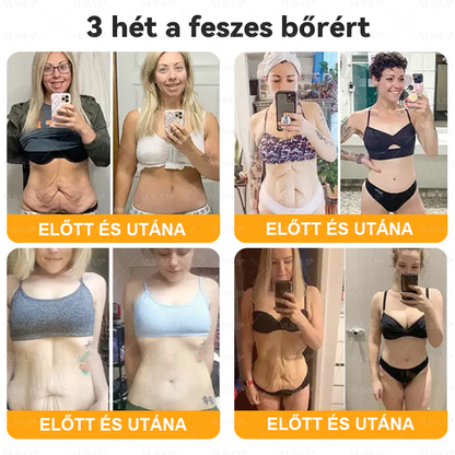 Magyarországról készült és szállított🌸VLSVLS® Méhméreg Bőrfelújító Krém 🔥🔥 UTOLSÓ NAP – 80% KEDVEZMÉNY