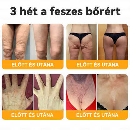 Magyarországról készült és szállított🐝🌸PUROSA® Méhméreg Bőrfelújító Krém 🔥 UTOLSÓ NAP – 80% KEDVEZMÉNY🔥