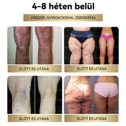 ⏰ Már csak 5 doboz maradt! További 50% kedvezményt kínálunk! Maradj fitt és egészséges. Ha most veszítesz, jövőre nem kapsz újabb esélyt.